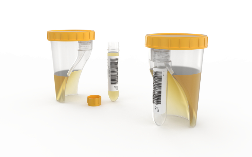 tubycon-u urine test cup