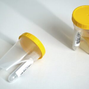 tubycon-u urine test cup