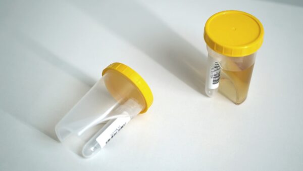 tubycon-u urine test cup