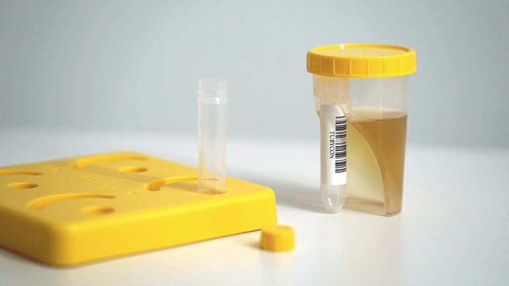 tubycon-u urine test cup