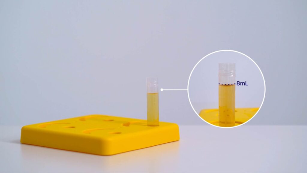 tubycon-u urine test cup notice